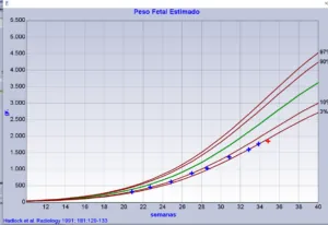 Meu bebê está pequeno (baixo peso fetal)! E agora?