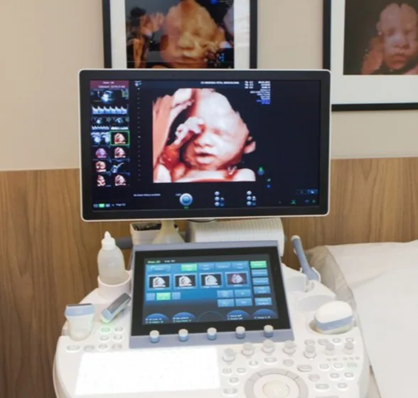 Equipamento de ultrassonografia – CR Medicina Fetal